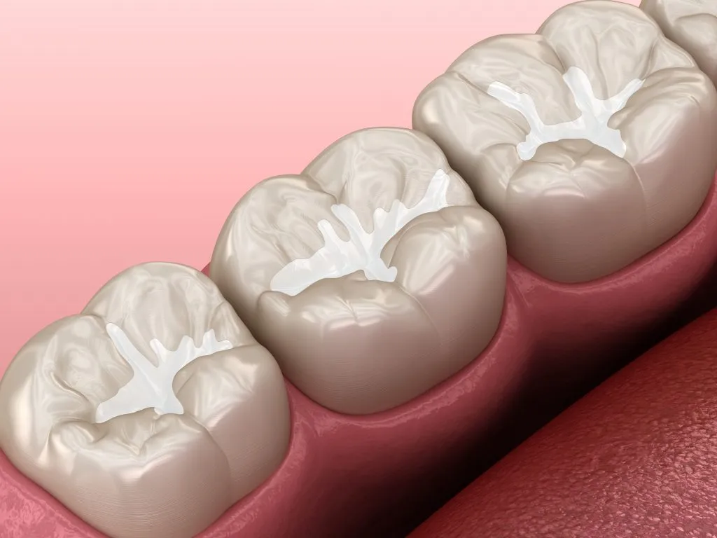 Fillings